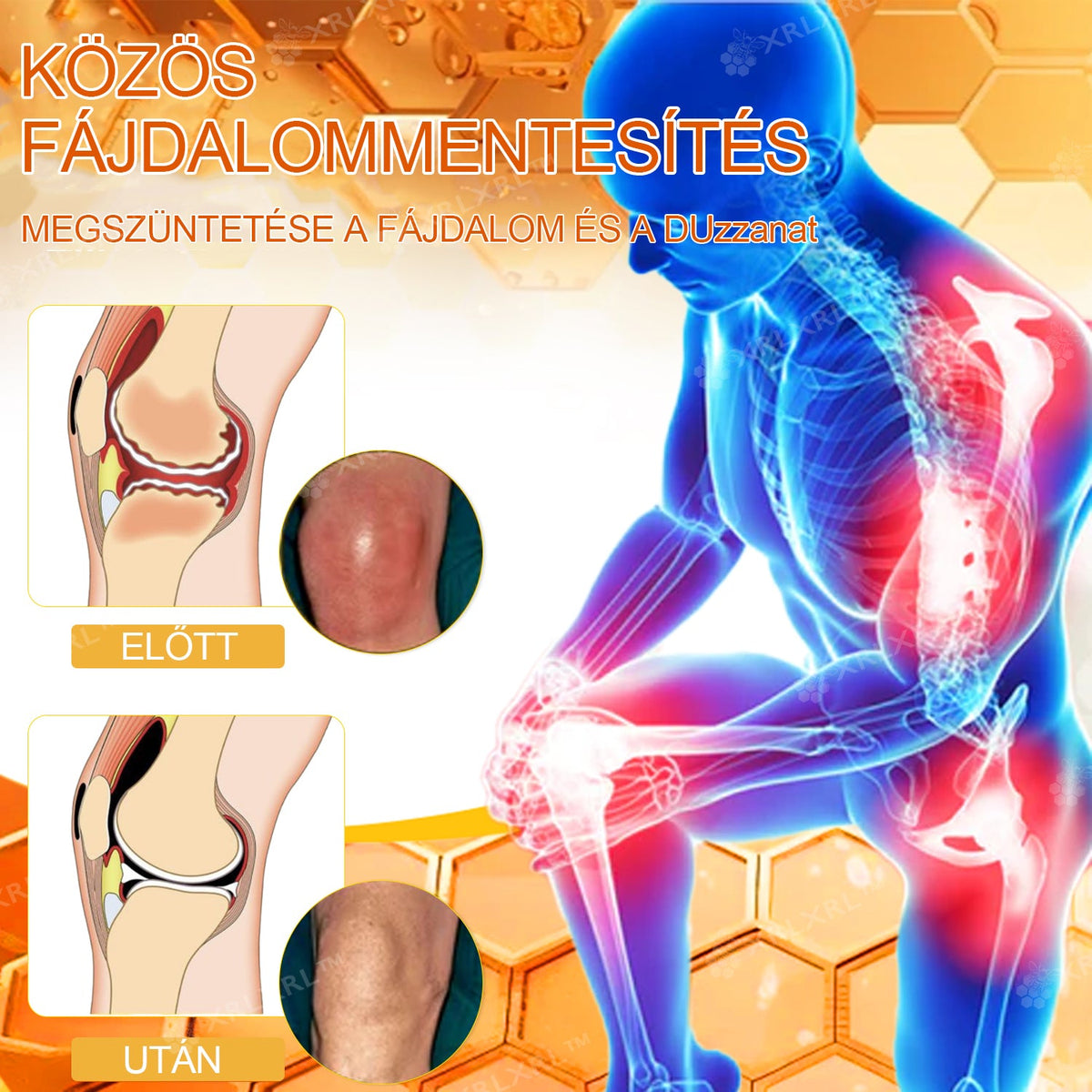 Hivatalos bolt: XRLXRL® Méhméreg Azonnali Ultra Erős Fájdalomcsillapító Krém - (👩‍⚕️👩‍⚕️Enyhíti a fájdalmat ízületi gyulladás, izomfájdalom, hátfájás, térdek, hát, vállak, csípők, csuklók, kezek esetén)
