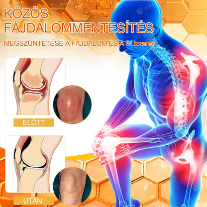 Hivatalos bolt: XRLXRL® Méhméreg Azonnali Ultra Erős Fájdalomcsillapító Krém - (👩‍⚕️👩‍⚕️Enyhíti a fájdalmat ízületi gyulladás, izomfájdalom, hátfájás, térdek, hát, vállak, csípők, csuklók, kezek esetén)