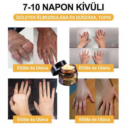 Hivatalos bolt: XRLXRL® Méhméreg Azonnali Ultra Erős Fájdalomcsillapító Krém - (👩‍⚕️👩‍⚕️Enyhíti a fájdalmat ízületi gyulladás, izomfájdalom, hátfájás, térdek, hát, vállak, csípők, csuklók, kezek esetén)