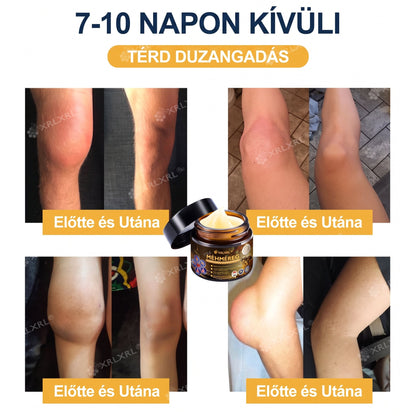 Hivatalos bolt: XRLXRL® Méhméreg Azonnali Ultra Erős Fájdalomcsillapító Krém - (👩‍⚕️👩‍⚕️Enyhíti a fájdalmat ízületi gyulladás, izomfájdalom, hátfájás, térdek, hát, vállak, csípők, csuklók, kezek esetén)
