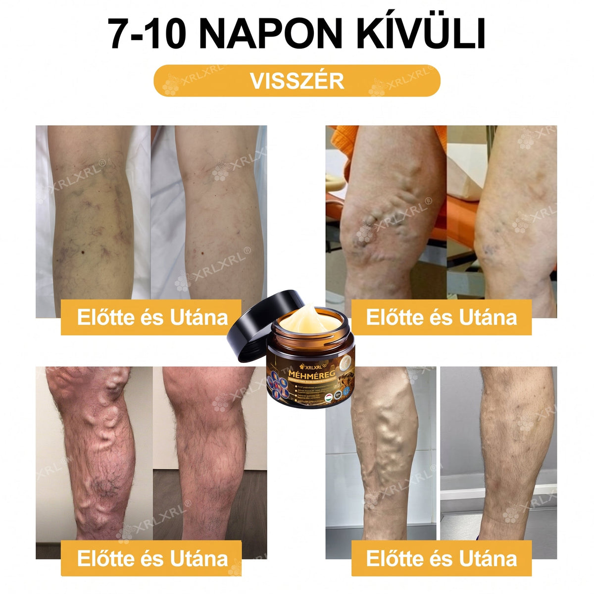 Hivatalos bolt: XRLXRL® Méhméreg Azonnali Ultra Erős Fájdalomcsillapító Krém - (👩‍⚕️👩‍⚕️Enyhíti a fájdalmat ízületi gyulladás, izomfájdalom, hátfájás, térdek, hát, vállak, csípők, csuklók, kezek esetén)