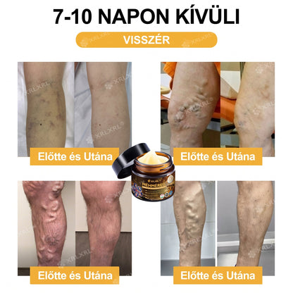 Hivatalos bolt: XRLXRL® Méhméreg Azonnali Ultra Erős Fájdalomcsillapító Krém - (👩‍⚕️👩‍⚕️Enyhíti a fájdalmat ízületi gyulladás, izomfájdalom, hátfájás, térdek, hát, vállak, csípők, csuklók, kezek esetén)